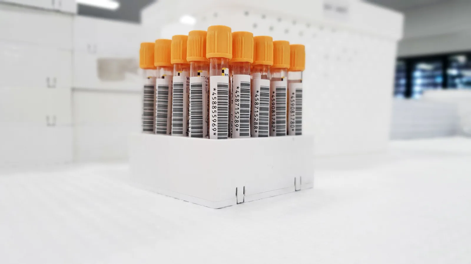 Blood sample test tubes labelled and racked in a pathology laboratory