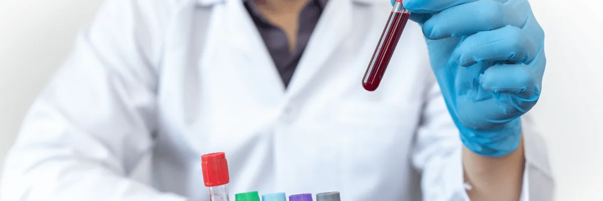 A laboratory worker holding a blood sample tube beside other sample tubes.